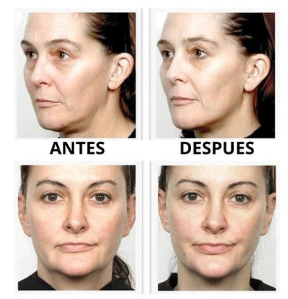Masajeador Facial Skindion con Microcorrientes para Piel Firme y Rejuvenecida